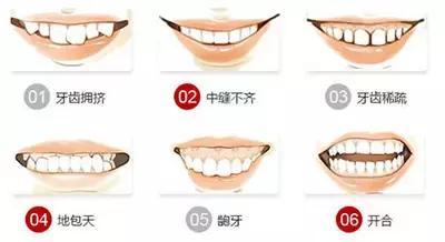 广东省口腔洗牙价格解析，费用构成与影响因素