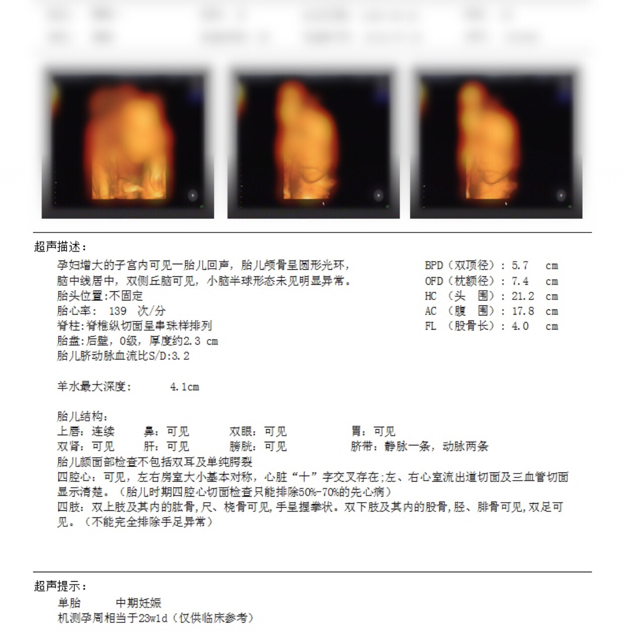 关于孕期几个月做四维的探讨