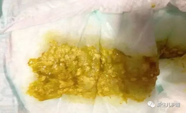 十个月宝宝拉肚子时，饮食调整至关重要。拉肚子可能会导致宝宝营养不足，因此选择合适的饮食不仅可以缓解宝宝的不适，还能为其提供必要的营养。本文将探讨十个月宝宝拉肚子期间应该吃哪些食物，以帮助宝宝恢复健康。